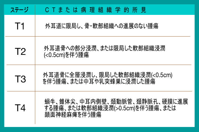 聴器がん(耳のがん)のステージ分類