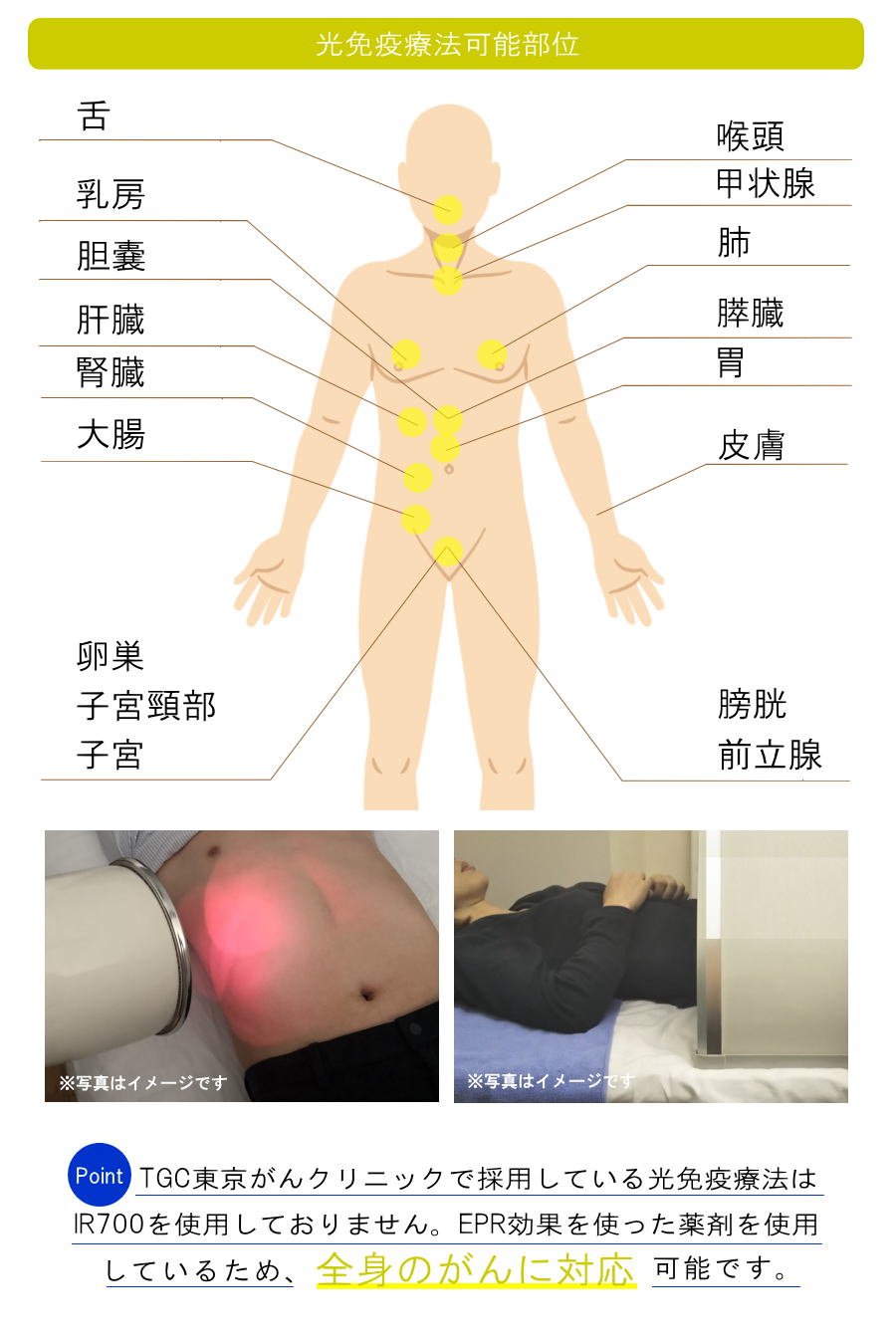 光免疫療法(千葉の方へご紹介)2