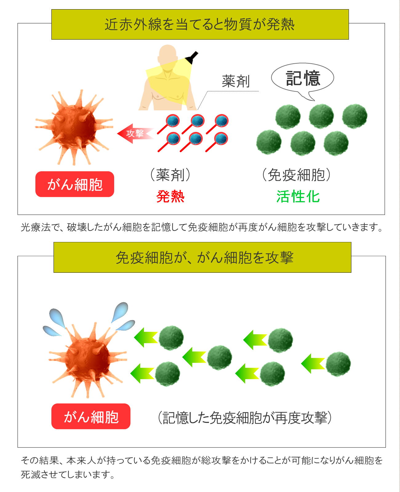 光免疫療法(千葉の方へご紹介)3