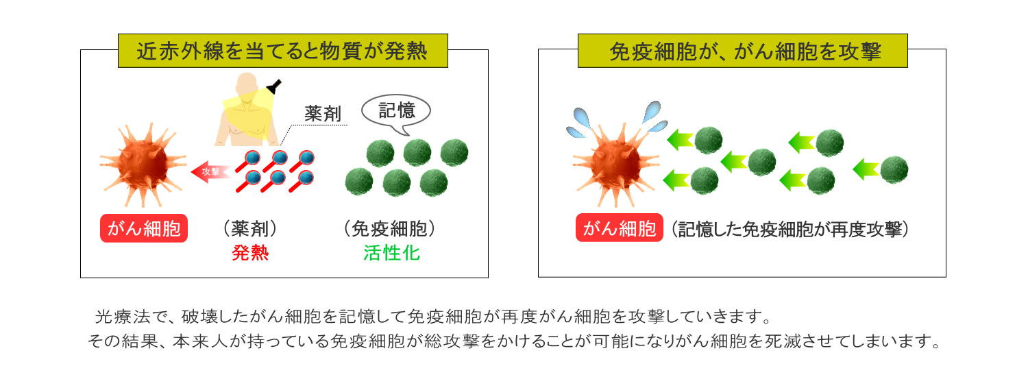 光免疫療法(千葉の方へご紹介)3