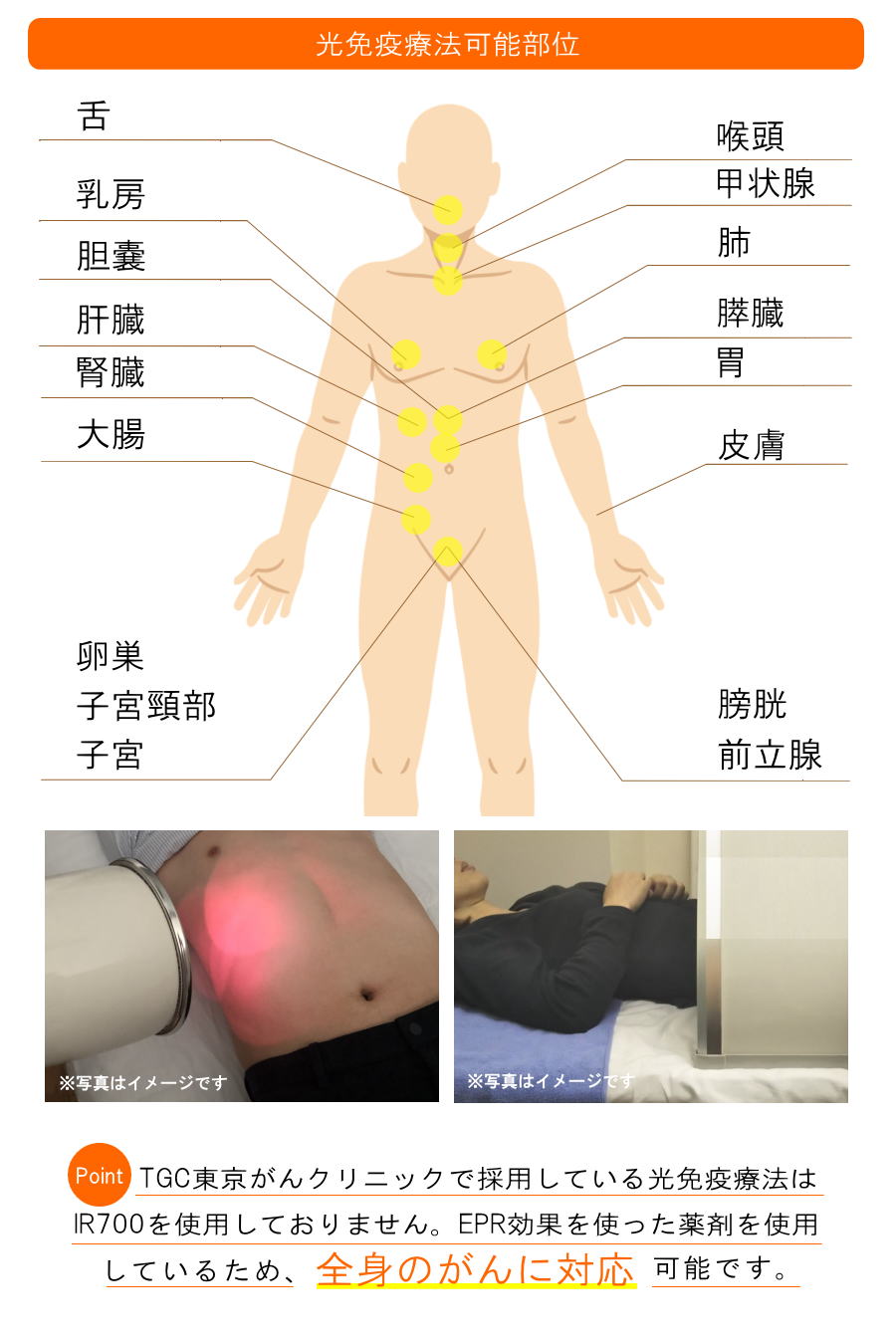 光免疫療法(静岡の方へご紹介)2