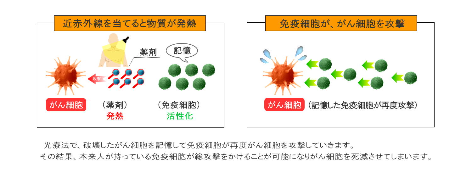 光免疫療法(静岡の方へご紹介)3